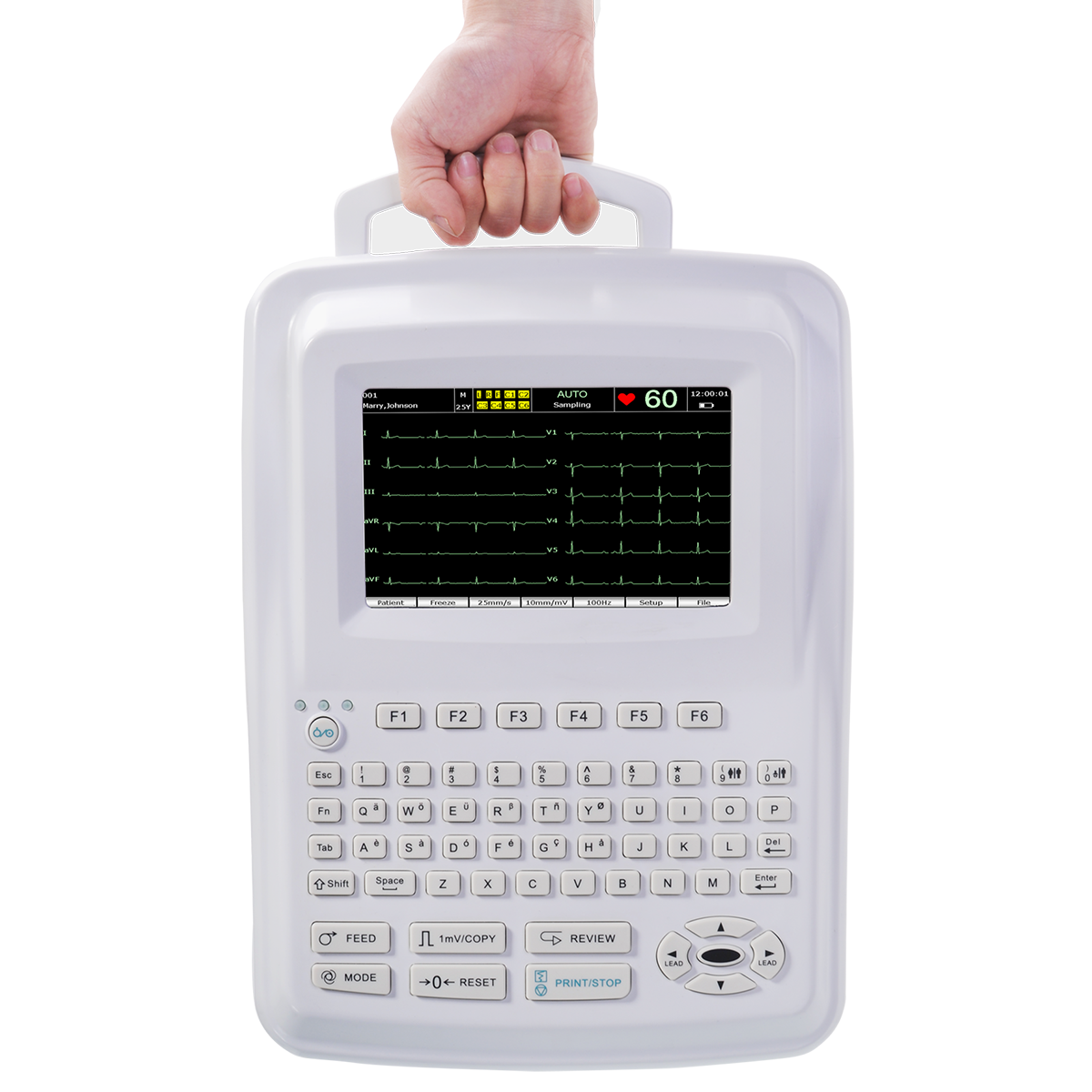 Electrocardiografo 12 canales LCD color tactil 7" c/algoritmo Glasgow interpret SE-1201