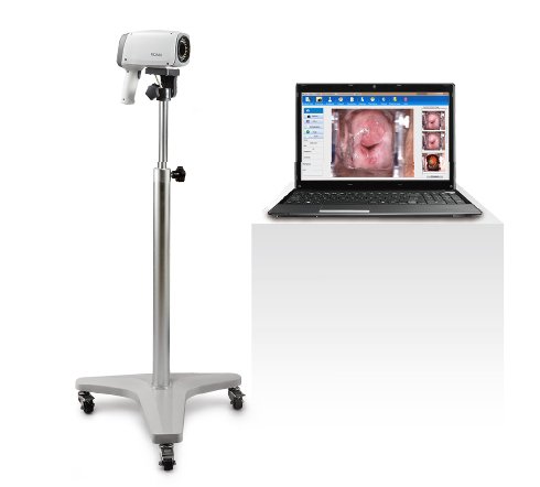 Videocolposcopio LED rodable 60x HD con parante vertical EDAN C6A HD